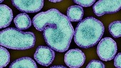 Human Influenza A virus, TEM