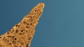 Baculagypsina foraminiferan, SEM