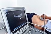 Ultrasound screening for abdominal aortic aneurysm