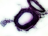 Artery cross-section, light micrograph