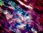 Cardiac muscle and other tissues, light micrograph
