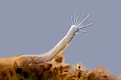 Dendrosoma suctorian ciliate, LM