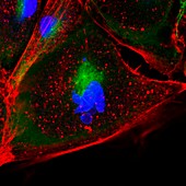 Fibroblast skin cells, fluorescence light micrograph