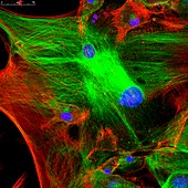 Fibroblast skin cells, fluorescence light micrograph