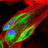 Fibroblast skin cells, fluorescence light micrograph