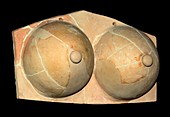 Ancient Greek breasts votive sculpture