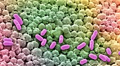 Nasal bacterial culture, SEM