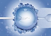 ICSI in vitro fertilisation, illustration