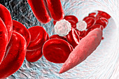 Leishmania protozoa in blood, illustration