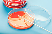Petri dishes against blue background