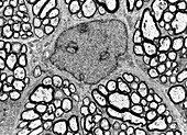 Fibrous astrocyte, TEM