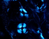 Osteons, polarised light micrograph