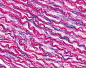 Wall of an elastic artery, light micrograph