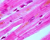 Heart muscle cells, light micrograph