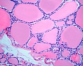 Thyroid follicles, light micrograph