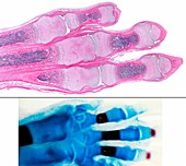 Ossification of hand bones, light micrographs