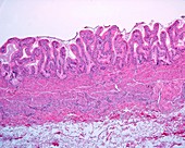 Gallbladder wall, light micrograph