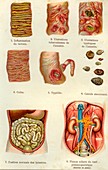 Intestine and kidney diseases, 19th C illustration