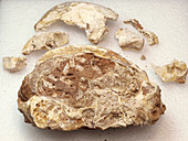 Fossil hominin skull and fragments (Aroeira 3)