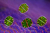 Micrasterias truncata algae, light micrograph