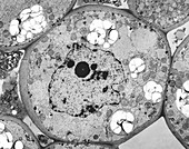 Plant parenchyma cell nucleus, TEM
