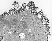 Herpes simplex virus, TEM