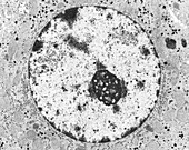 Liver cell nucleus, TEM
