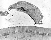 Protozoan intestine infection (Giardia sp.), TEM