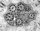 Epithelial cilia microtubules (cross section), TEM