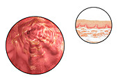 Oesophagus wall, light micrograph and illustration