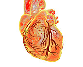 Heart with coronary vessels, illustration