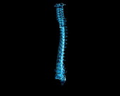Spine X-ray 1