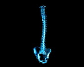 Spine Pelvis X-Ray 1