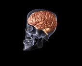 X-ray Skull Brain 2