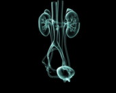 Renal System X-Ray 1