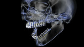 X-ray Skull Teeth