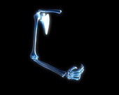 Arm Bones X-Ray 2
