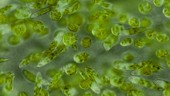 Euglena sp in algal bloom, light microscopy