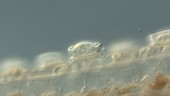 Trichodina ciliates on Hydra tentacle, LM