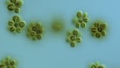 Synura petersenii golden algae, LM