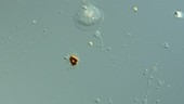 Cochliopodium amoeba, LM