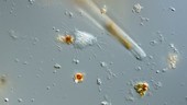 Leptophrys amoeba timelapse, LM