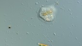 Cochliopodium amoeba timelapse, LM