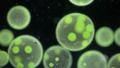 Volvox algae colonies, light microscopy