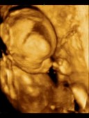 20-week-old foetus, 3D ultrasound scan