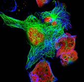 Neuroblastoma cells, fluorescence light micrograph