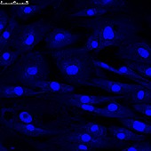 Fibroblast skin cells, fluorescence light micrograph