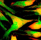 Fibroblast skin cells, fluorescence light micrograph