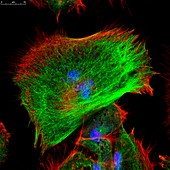 Fibroblast skin cells, fluorescence light micrograph