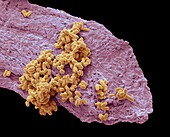 Bacterial culture from the umbilicus, SEM